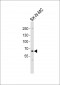 PCSK9 Antibody (C-term)